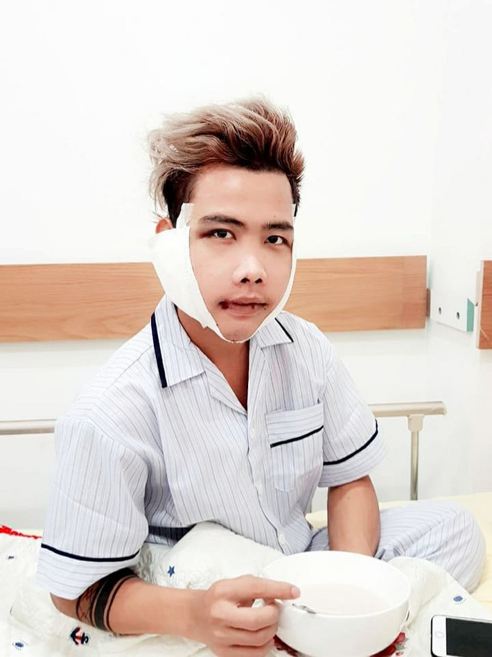 Hình ảnh của Tùng Sơn chỉ sau 3 ngày phẫu thuật thay đổi toàn diện khung xương hàm mặt (xương gò má, xương hàm trên, hàm dưới, góc hàm và xương cằm). Anh chàng còn nêu quan điểm: "Không có người phụ nữ nào xấu cả mà là người ta chưa muốn làm đẹp thôi... Phẫu thuật xong em xin đọ sắc cùng Ngọc Trinh nhé!".