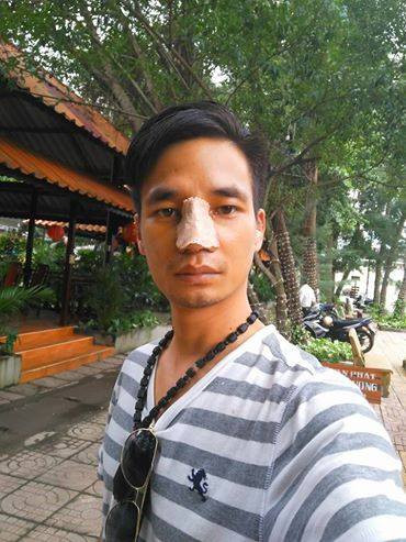 Có vẻ như ngoài mục đích giúp công việc kinh doanh của mình thêm thuận lợi hơn, quyết định nhờ đến sự can thiệp của "dao kéo" để cải thiện dung mạo lần này của Đức Hậu có thể còn vì anh muốn mình thoát khỏi quá khứ được nhiều người chú ý với nghệ danh "ca sĩ Lệ Rơi".
