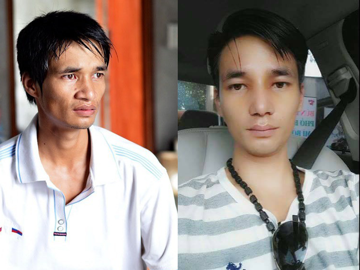 Mặc dù nhận được nhiều lời khuyên nên cân nhắc trước khi nhờ đến sự can thiệp của "dao kéo" nhưng hôm 23/7 vừa qua Lệ Rơi (tên thật Nguyễn Đức Hậu, sinh năm 1987, ở Hải Dương) vẫn quyết định tiến hành phẫu thuật thẩm mỹ một vài điểm thiếu hài hòa trên khuôn mặt như chiếc mũi hơi to và bè ra. Ảnh: FBNV.