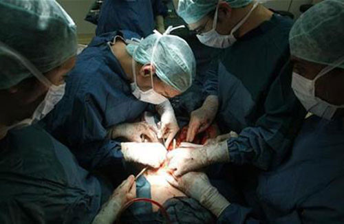 Ngoài ra, còn nhiều kỹ thuật ghép đơn giản khác mà các bác sĩ Việt hoàn toàn có thể thực hiện một cách dễ dàng. Nguồn ảnh: BV Việt Đức, Trung tâm Điều phối ghép tạng quốc gia.