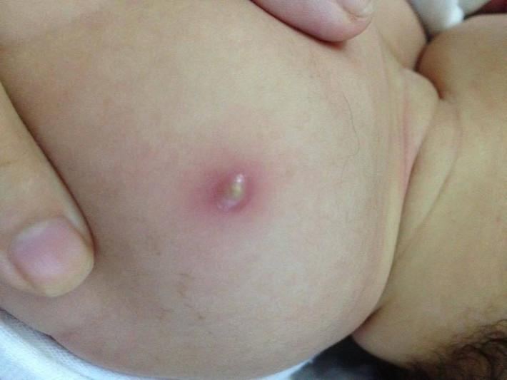 Trị chứng lở loét, mụn nhọt ngoài da: Lấy thân cây chóc gai nấu nước lên tắm, rửa hằng ngày. Ảnh: Cẩm nang sức khỏe.