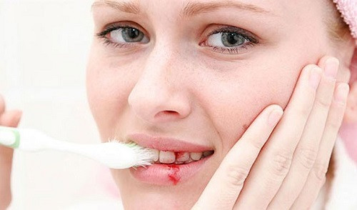 Người bị chảy máu chân răng, tụt lợi cũng lấy rễ mù u sắc lên cùng rễ cây kỷ ngậm. Ảnh: Nha khoa paris.