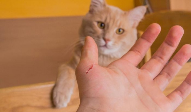 Khi bị nhiễm vi khuẩn này trên da bạn xuất hiện những vết sưng đỏ, nổi mụn nước quanh chỗ bị cắn hoặc cào, sốt, đau đầu, đau khớp.... Bệnh thường tự hết hoặc có thể dùng kháng sinh nếu cần. Ảnh: Heathplus.