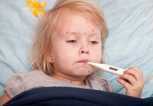 Trường hợp trẻ bị sởi để kích thích cho các nốt sởi mọc nhanh và lặn nhanh có thể lấy lá khế đun lấy nước cho trẻ uống và nấu nước vỏ cây khế và lá cho trẻ tắm sau khi bệnh đã khỏi. Ảnh: Alo bác sĩ.