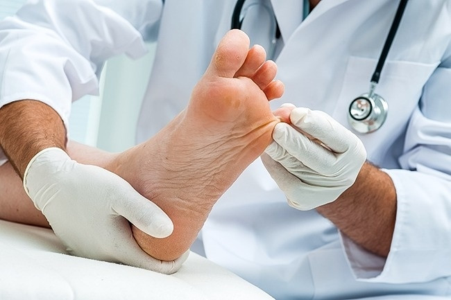 Ngoài ra, để mùi hôi chân không ghé thăm mọi người nên giữ giày khô thoáng, hạn chế đi giày vào mùa hè vì mồ hôi chân tiết ra rất nhiều… khi có dấu hiệu bị bệnh hôi chân kéo dài có thể do một số yếu tốt bất thường trong cơ thể cần đến ngay cơ sở y tế chuyên khoa uy tín để bác sĩ khám, tìm hiểu nguyên nhân và điều trị triệt để. Ảnh: Bestie.