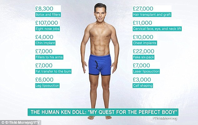 Rodrigo Alves đã tiêm Botox, chất làm đầy, nâng mũi, độn cằm, tiêm chất làm đầy vào cánh tay, hút mỡ ở chân, cấy tóc, căng da mặt, cổ, mắt, bơm ngực, tạo 6 múi giả… (Ảnh: ThismorningTV)
