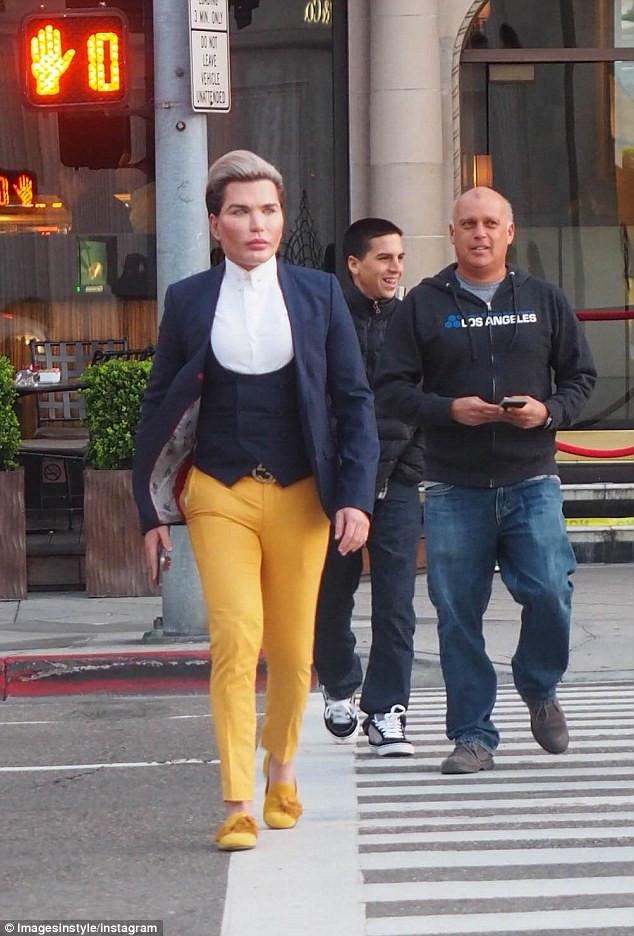 Vài tuần trước, Rodrigo Alves đã làm liền ba ca căng da cổ, mặt và mắt trong một ngày. Chính việc này khiến khuôn mặt anh nham nhở những vết sẹo chằng chịt. (Ảnh: Instagram)