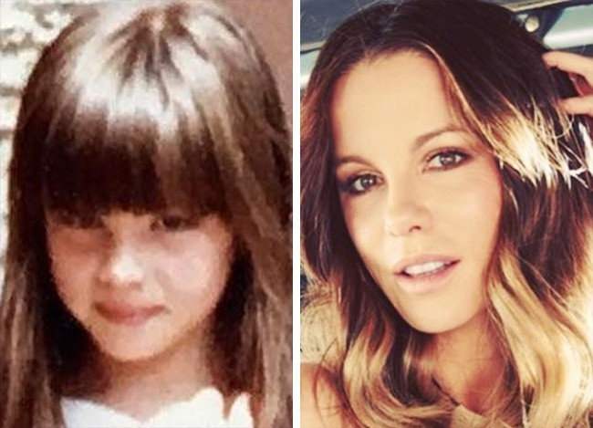 Người đẹp Kate Beckinsale từng gây tranh cãi rằng liệu khuôn mặt của cô có đụng đến "dao kéo" hay không.