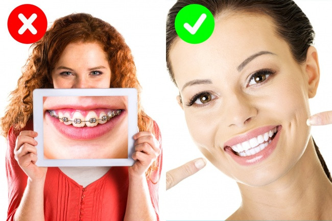 Sử dụng loại kem đánh răng chứa chất florua đặc biệt nguy hiểm cho trẻ em vì nó dẫn đến sự phát triển của răng không đúng và những chỗ trắng trên răng.