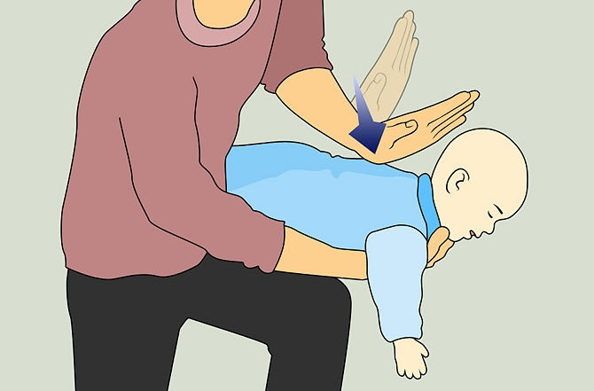 Để phòng tránh, các mẹ không nên cho bé tự ý ăn các loại hạt. Nếu phát hiện con bị hóc mẹ hay sơ cứu cho con bằng cách vỗ lưng hoặc ép vào cơ hoành để đẩy dị vật ra ngoài, sau đó đưa bé đến trung tâm y tế gần nhất.