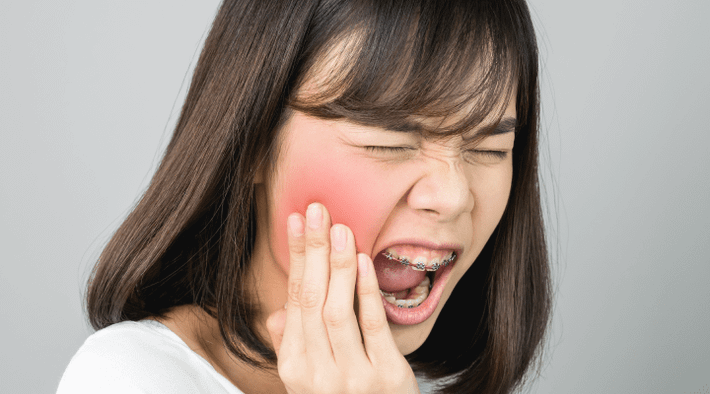 Các triệu chứng thường gặp bao gồm đau miệng, khô miệng, chảy máu niêm mạc..., Do cảm giác đau nhức, khó chịu nên người bệnh thường gặp khó khăn trong việc ăn uống, thậm chí ảnh hưởng đến phát âm, giọng nói.