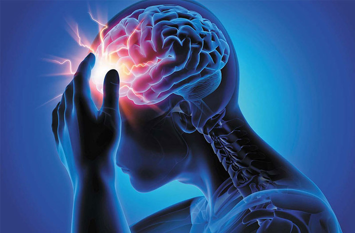 Nói đến nhồi máu não thì chắc ai cũng từng nghe nhưng tình hình cụ thể của nhồi máu não thì có chút nhầm lẫn. Nói một cách đơn giản, đây là hiện tượng xuất hiện các cục máu đông trong mạch máu não, làm tắc nghẽn quá trình lưu thông của mạch máu lên não và dẫn đến nhồi máu não.