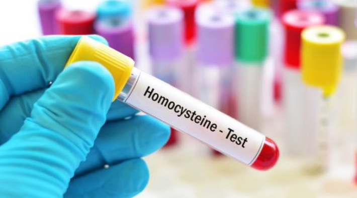 Những bà mẹ mang thai có homocysteine trong máu cao có tỷ lệ mắc các biến chứng thai kỳ (như tiền sản giật, sinh non và trẻ sơ sinh nhẹ cân) hơn những bà mẹ mang thai bình thường, tỷ lệ mắc các dị tật bẩm sinh như nứt đốt sống và bàn chân dị dạng là ở đời con cũng cao hơn. Và nguy cơ sẩy thai liên tiếp gấp 3 - 4 lần phụ nữ bình thường.