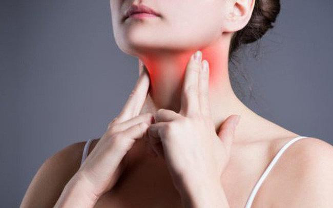 Hóa trị là phương pháp điều trị ung thư hạch cổ chủ yếu.