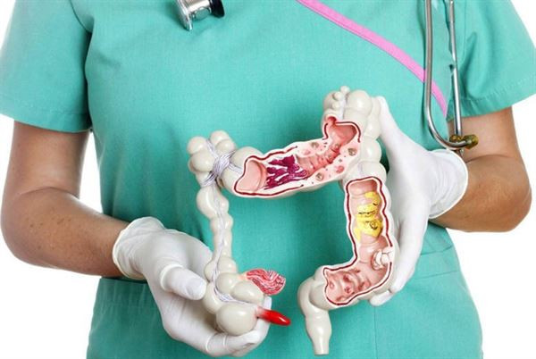 3. Ung thư đại trực tràng: Bệnh nhân phát triển thành ung thư đại trực tràng do gen mẫn cảm trong gia đình và bệnh di truyền chiếm khoảng 10% đến 15% tổng số bệnh nhân ung thư đại trực tràng. Nếu có ai đó trong gia đình bị ung thư, nguy cơ của họ cao hơn dân số chung hơn 3-4 lần.