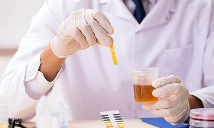 Thế nhưng, một số bệnh cũng có thể khiến nước tiểu chuyển sang màu xanh lam, chẳng hạn như tăng canxi máu nguyên phát, ngộ độc vitamin D, tắc mật và nhiễm trùng Pseudomonas aeruginosa. Nếu tình trạng này kéo dài, cần đi khám kịp thời để được tư vấn và điều trị.