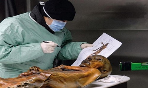 Xác ướp người băng Ötzi nổi tiếng thế giới khi có nhiều hình xăm trên cơ thể nhìn thấy rõ dù đã qua đời từ hàng ngàn năm trước.