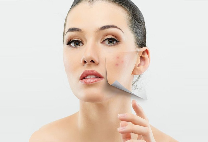 Tốt cho da: Một số nghiên cứu chỉ ra rằng các hormone tiêm vào động vật trước khi tiêu thụ có thể ảnh hưởng đến làn da của con người bằng cách gây ra các vấn đề như mụn trứng cá, trứng cá đỏ, chàm... Chuyển sang chế độ ăn nhiều rau xanh giúp bạn có một làn da khỏe mạnh bởi rau quả rất giàu chất chống oxy hóa và chất xơ.