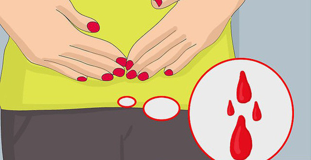 Kinh nguyệt ra ít: Một dấu hiệu sớm của bệnh ung thư buồng trứng là kinh nguyệt ra ít hơn, thậm chí là mãn kinh do chức năng buồng trứng sẽ suy giảm trong khi khối u phát triển sẽ ảnh hưởng đến lưu lượng kinh nguyệt tiết ra. Chính vì vậy, nếu bạn chỉ thấy máu ra nhỏ giọt trong chu kỳ kinh nguyệt, kèm theo triệu chứng đau hoặc một vài sự thay đổi khác trong chu kỳ thì tốt nhất nên đi khám ngay.