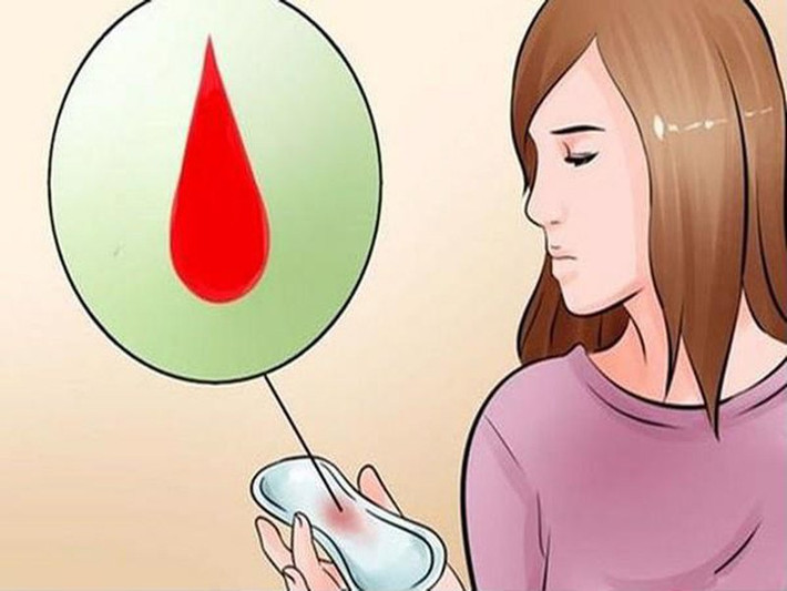 Chảy máu bất thường: Không phải trong kỳ kinh nguyệt mà cũng chảy máu ở vùng kín thì bạn cần xem lại sức khỏe ở "vùng dưới" của mình. Người mắc bệnh ung thư buồng trứng có thể gặp ảnh hưởng liên quan đến quá trình tiết hormone sinh sản, từ đó là nguyên nhân gây chảy máu âm đạo bất thường.
