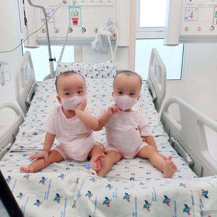 Đến lúc Trúc Nhi - Diệu Nhi 13 tháng tuổi, cuộc mổ "lịch sử" tách rời cơ thể cho hai bé được diễn ra tại Bệnh viện Nhi đồng thành phố.