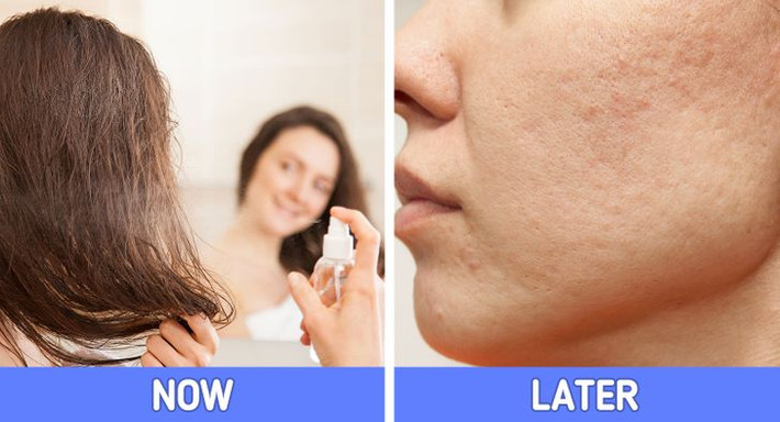 5. Dùng nhiều sản phẩm liên quan đến tóc: Một số sản phẩm giúp tóc bóng khỏe, đồng thời có thể gây mụn trên khuôn mặt của bạn. Dầu gội, dầu xả và các sản phẩm tạo kiểu tóc sẽ làm mụn cám mọc theo chân tóc của bạn (đặc biệt là vùng trán). Nếu những sản phẩm này dính vào mặt, chúng có thể làm tắc lỗ chân lông và gây kích ứng da.
