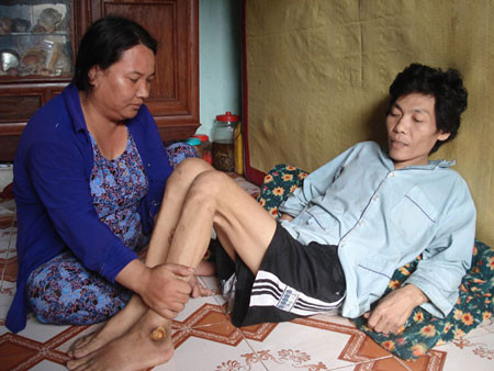 Theo thống kê của Phòng LĐTB & XH huyện Bình Sơn và Lý Sơn, trung bình mỗi năm có 15 vụ ngư dân gặp nạn khi lặn đánh bắt hải sâm trên biển, trong đó không ít người phải bỏ mạng hoặc bị các tai biến sống thực vật. Ảnh: Thợ lặn Trần Đình Lộc, 45 tuổi, ở thôn Tây, xã An Hải, huyện Lý Sơn (Quảng Ngãi), bị liệt sau khi gặp tai nạn trong chuyến lặn biển năm 2006 (Nguồn: Sài Gòn tiếp thị).