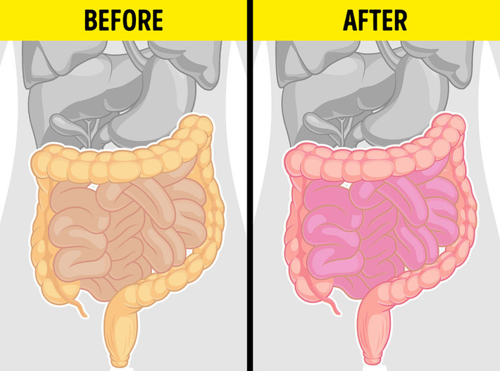 Cà chua có thể kích hoạt hội chứng ruột kích thích (IBS): Nếu bạn bị IBS, cà chua thực sự có thể kích hoạt các triệu chứng. Chúng bao gồm tiêu chảy, chuột rút đau đớn, đầy hơi, chướng bụng và táo bón. Trong trường hợp này, tốt nhất là tránh xa các thực phẩm có tính axit như cà chua và sốt cà chua.