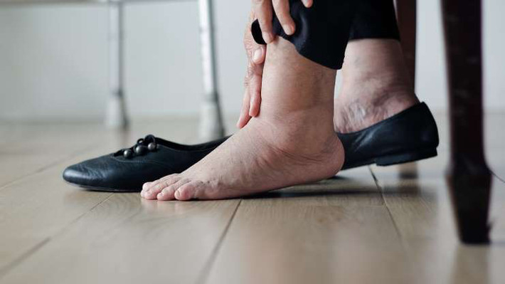 Ngồi nhiều khiến máu lưu thông kém, các bộ phận trên cơ thể không nhận đủ ô xy, dẫn tới tình trạng tê bì.