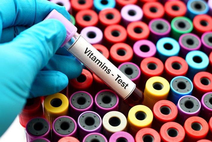 Thiếu vitamin: Thiếu vitamin B12 có thể gây thiếu máu ác tính - một bệnh tự miễn. Bệnh này thường do chế độ ăn thiếu vitamin B, hoặc do cơ thể mắc các bệnh về tiêu hóa dẫn đến không thể hấp thu các vitamin từ thực phẩm.
