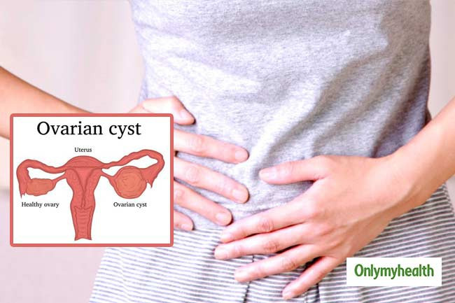 Chảy máu bất thường: Nếu bạn thấy máu chảy bất thường ở vùng kín khi không trong kì kinh nguyệt, đó có thể là dấu hiệu u nang buồng trứng.