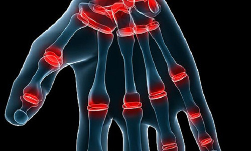 Cuối cùng, nếu bạn hay bẻ khớp ngón tay chân khi con trẻ thì nguy cơ bạn bị đau nhức mỏi khớp tay chân khi về già sẽ ngày càng tăng cao. Nguồn ảnh: Benhxuongkhop, giainhan.