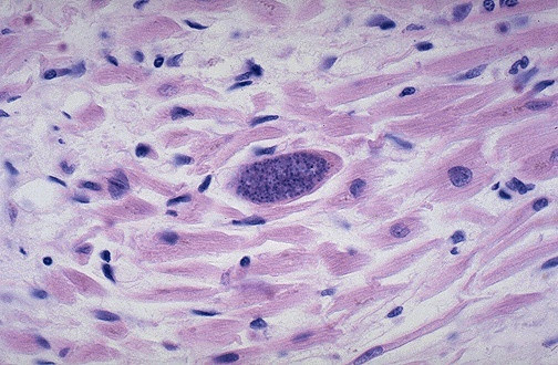 Nguy hiểm hơn cả mèo có thể làm bạn nhiễm vi khuẩn Toxoplasma. Nếu bạn đang mang thai bị nhiễm loại vi khuẩn này có thể sẽ gây ra dị tật bẩm sinh cho thai nhi trong bụng.