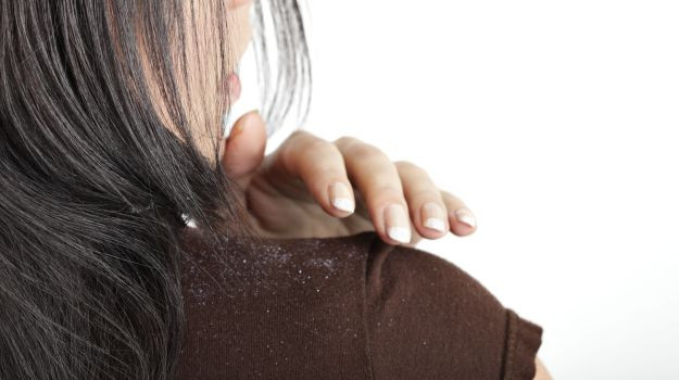 Trị gàu: Giấm táo cũng có tác dụng trị gàu hiệu quả. Trộn 1/4 chén giấm với ¼ chén nước vào một bình xịt, rồi xịt lên tóc và da đầu. Sau đó, dùng khăn ủ trong vòng 15 phút gội sạch lại bằng nước. Ngoài ra, bạn cũng có thể hòa giấm táo cùng với nước gội đầu bình thường mà bạn hay dùng.