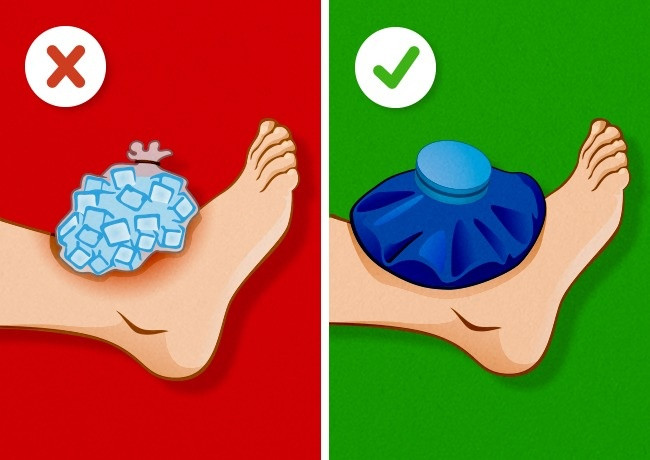 10. Trườm đá vào vết thâm tím: Đá thực sự là có thể làm giảm thâm tím nhưng bạn không nên đặt chúng trực tiếp lên da bởi bạn có thể bị bỏng lạnh. Cách làm đúng là đặt một miếng vải giữa đá và da. Chườm đá 20 phút, bỏ đá ra, đợi khoảng 20 phút rồi mới chườm tiếp 10 phút. Lặp lại như vậy vài lần. Ảnh: Brightside.