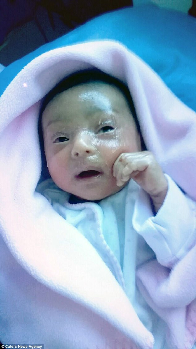 Ngoài ra, mẹ của bé còn liên tục phải thay ga trải giường và chăn gối bởi chúng thường xuyên bị ẩm ướt do kem dưỡng ẩm bôi cho Maryam. Ảnh: CNA.