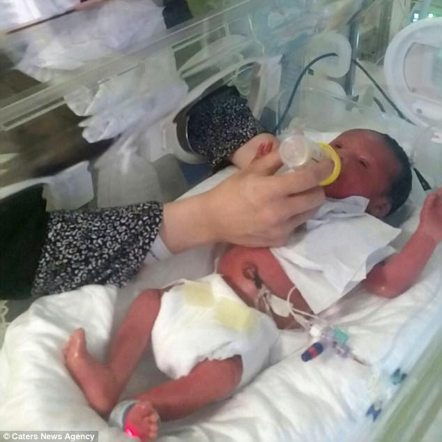 Khi mới chào đời, Maryam có làn da đỏ tươi và sáng bóng như một con búp bê nhựa, chứ không giống đứa trẻ sơ sinh. Cô bé phải nằm trong phòng chăm sóc đặc biệt. Ảnh: CNA.