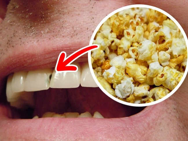 5. Bắp rang bơ: Bạn đã bao giờ nghĩ mình sẽ xem phim ở rạp mà không có bắp rang bơ? Đây có lẽ là ý tưởng rất lành mạnh bởi bắp rang bơ có thể làm hỏng men răng và khiến răng yếu. Bên cạnh đó, thực phẩm ngọt này bao gồm các carbohydrate tạo thành glucose có hại. Ảnh: Pixabay.