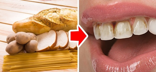 3. Bánh mì, mì ống, và khoai tây: Thực phẩm có chứa rất nhiều tinh bột dính vào răng và ở lại trong miệng trong một thời gian dài. Tinh bột gây ra sự hình thành một vùng mảng bám răng. Ngoài ra, tinh bột biến thành đường khi tiếp xúc với nước bọt. Điều này có thể dẫn đến sâu răng và các vấn đề nghiêm trọng khác. Ảnh: Pixabay.