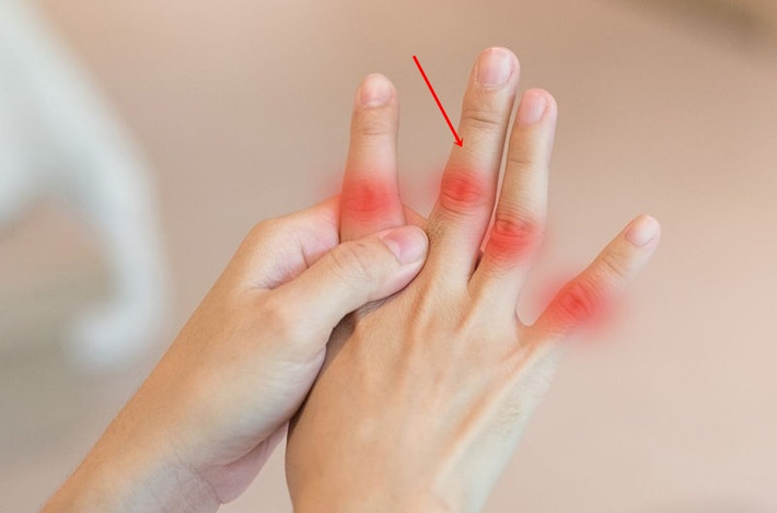 Nếu bạn muốn biết lá gan của mình có khỏe không, hãy đưa ngón tay giữa lên để quan sát.