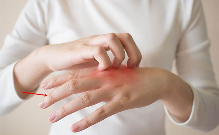 Điều này có thể hiểu là, nếu gan của có một số vấn đề, móng tay giữa thường mỏng hơn, giòn và dễ gãy nhất. Ngược lại, nếu gan khoẻ mạnh, hoạt động trơn tru và bình thường thì móng tay của ngón tay giữa sẽ mềm mượt, hồng hào.