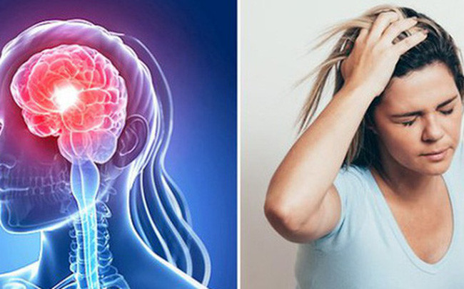 Nhồi máu não cũng có tỷ lệ tàn phế cao, dù đã được điều trị hiệu quả, tình trạng bệnh ổn định thì vẫn để lại những di chứng rất nặng nề cho người bệnh, ảnh hưởng nghiêm trọng đến cuộc sống sau này của người bệnh và làm tăng áp lực về thể chất và tâm lý của người bệnh.