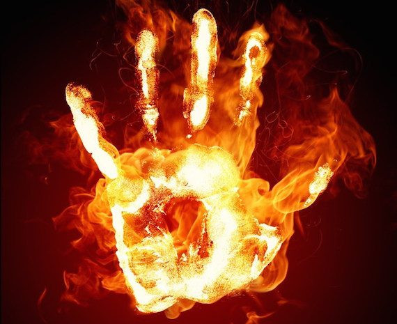 Theo một số tài liệu, trường hợp đầu tiên vướng phải hiện tượng những bàn tay tự bốc cháy là một người thợ rèn có tên Renateau sống ở ngôi làng nhỏ Loignan, Bordeaux, Pháp.