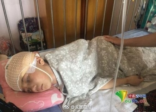 Theo thông tin đăng tải, cậu bé tội nghiệp bị mẹ kế ngược đãi tên là Đồng Bằng Bằng, năm nay 6 tuổi, nhà ở Thiểm Tây, Trung Quốc. Khi được đưa đến bệnh viện, Bằng Bằng ở trong tình trạng hôn mê sâu, tim ngừng đập tạm thời. Mãi đến khi được cấp cứu, tim của cậu bé mới đập trở lại. (Nguồn Sina)