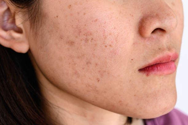 Chính vậy, một người có khỏe mạnh hay thân mình đầy bệnh tật, chỉ cần nhìn sắc mặt là có thể đoán biết. Sắc mặt được xem là nơi "báo cáo" tình hình sức khỏe lục phủ ngũ tạng của một người, phản chiếu những mối nguy tiềm tàng bên trong cơ thể.