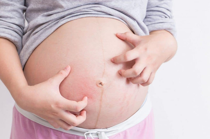 Nói như thế để thấy, nếu mẹ bầu muốn giảm độ đục của nước ối thì phải giảm tình trạng thiếu oxy và phòng ngừa ứ mật. Cụ thể, phải sửa ngay những thói quen xấu sau đây. Thứ nhất, nằm trên giường quá nhiều.