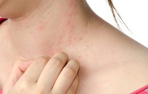 Các tác dụng phụ này có thể gây ảnh hưởng đến khả năng thực hiện các hoạt động hàng ngày, nhưng sẽ biến mất sau một thời gian ngắn. Một số người không có tác dụng phụ.