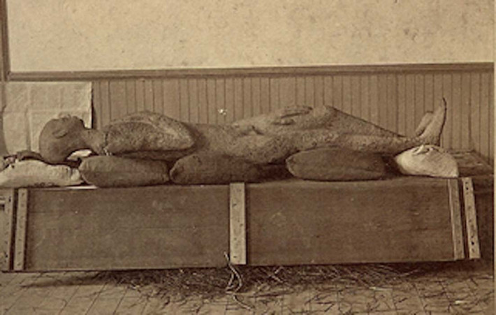 Năm 1877, truyền thông và dư luận Mỹ dồn nhiều sự quan tâm vào phát hiện tìm thấy thi hài một người đàn ông thời tiền sử bị hóa đá. Thi hài này được gọi là Solid Muldoon.