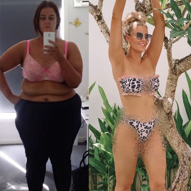 Lúc còn nặng gần 170kg, Anderson từng thở phì phò, không nhấc nổi chân sau khi đi bộ 20 phút, lúc nào cũng ăn thức ăn nhanh và 99% thực phẩm nạp vào cơ thể là đồ chế biến sẵn. Không chỉ gặp nhiều khó khăn vì thân hình quá khổ, không thể mặc trang phục yêu thích, cô còn có nguy cơ mắc phải nhiều bệnh liên quan đến béo phì.