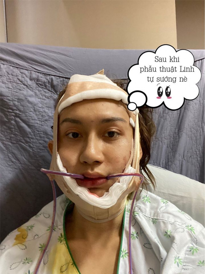 Lynk Lee cho biết, trước khi phẫu thuật chuyển giới, cô đã thực hiện một số ca thẩm mỹ nhỏ như sửa mắt, mũi và tiêm má baby, tuy nhiên vẫn chưa thực sự hài lòng.